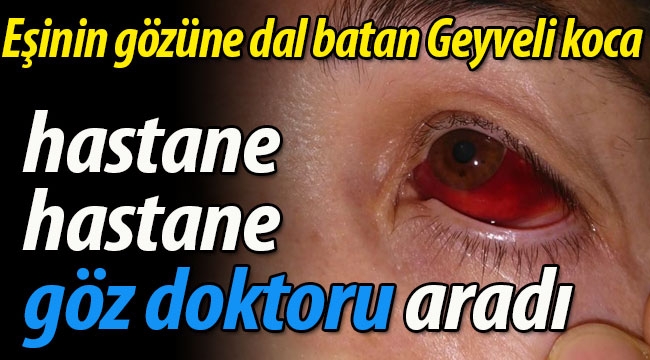 Eşinin gözüne dal batan Geyveli kocadan doktor tepkisi