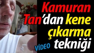Kamuran Tan'dan kene çıkarma tekniği