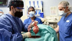 Dünyada bir ilk: Domuzdan insana kalp nakli