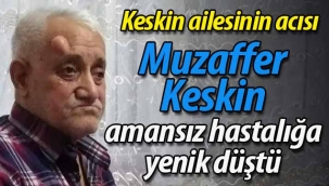 Muzaffer Keskin amansız hastalığa yenik düştü