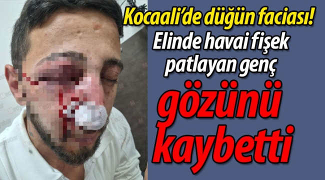 Elinde havai fişek patlayan genç, gözünü kaybetti