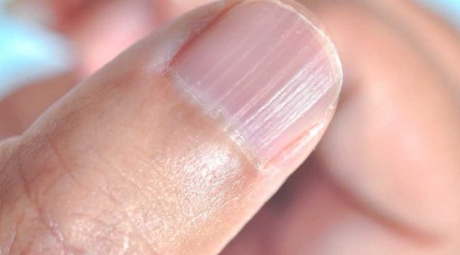 Sadece karaciğer ve nar değil: Beslenme uzmanı demir açısından zengin besinleri sıraladı